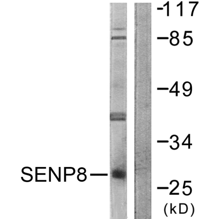 Western Blot - Anti-SENP8 Antibody (C0371) - Antibodies.com