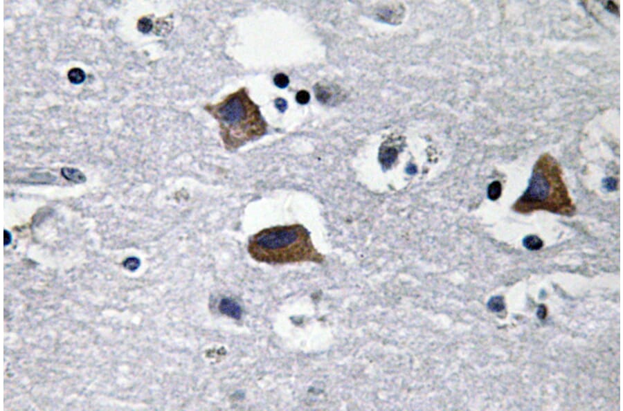Immunohistochemistry - Anti-SDF-1 Antibody (R12-2347) - Antibodies.com