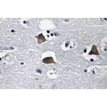 Immunohistochemistry - Anti-SDF-1 Antibody (R12-2347) - Antibodies.com