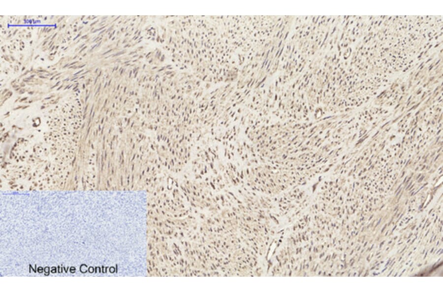 Immunohistochemistry - Anti-SDF-1 Antibody (R12-2347) - Antibodies.com