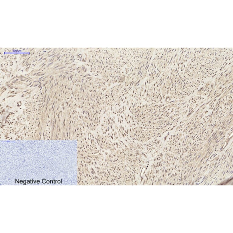 Immunohistochemistry - Anti-SDF-1 Antibody (R12-2347) - Antibodies.com