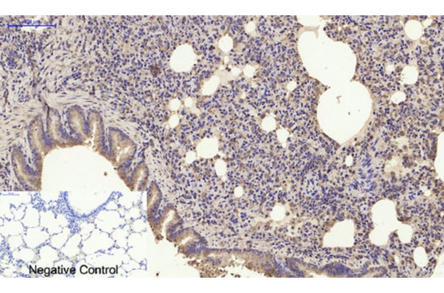 Immunohistochemistry - Anti-SDF-1 Antibody (R12-2347) - Antibodies.com