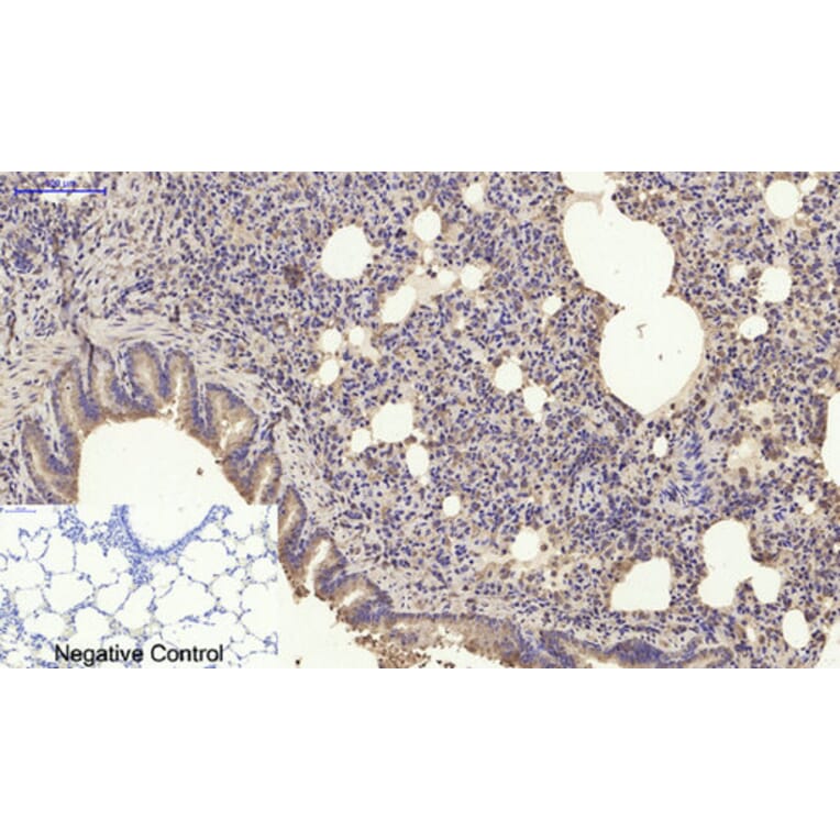 Immunohistochemistry - Anti-SDF-1 Antibody (R12-2347) - Antibodies.com