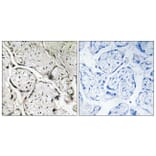 Immunohistochemistry - Anti-SAR1B Antibody (C16030) - Antibodies.com