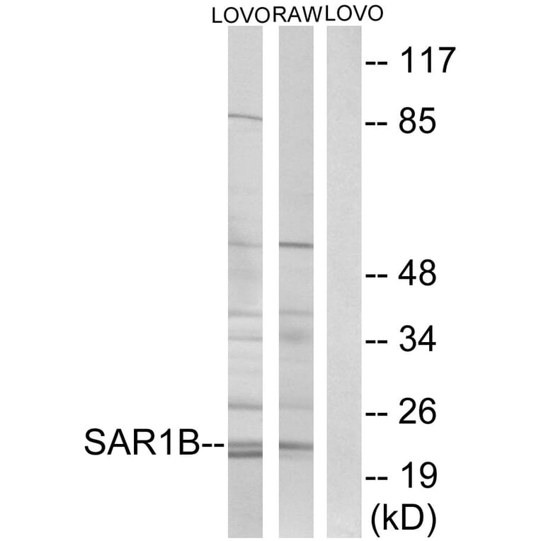 Western Blot - Anti-SAR1B Antibody (C16030) - Antibodies.com