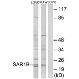 Western Blot - Anti-SAR1B Antibody (C16030) - Antibodies.com