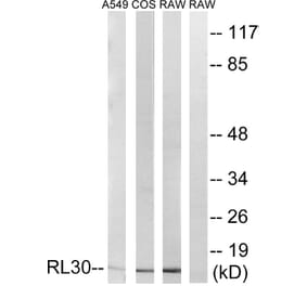 Western Blot - Anti-RPL30 Antibody (C14169) - Antibodies.com
