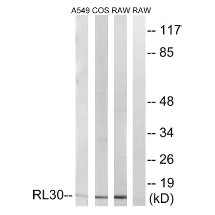 Western Blot - Anti-RPL30 Antibody (C14169) - Antibodies.com