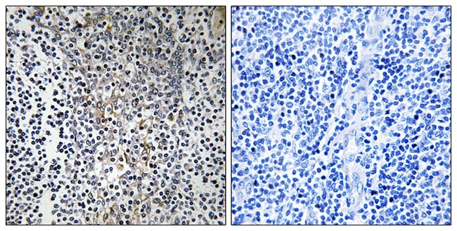 Immunohistochemical analysis of paraffin-embedded human tonsil tissue using Anti-RPL23 Antibody. The right hand panel represents a negative control, where the antibody was pre-incubated with the immunising peptide.