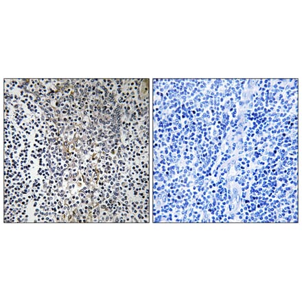 Immunohistochemistry - Anti-RPL23 Antibody (C14159) - Antibodies.com