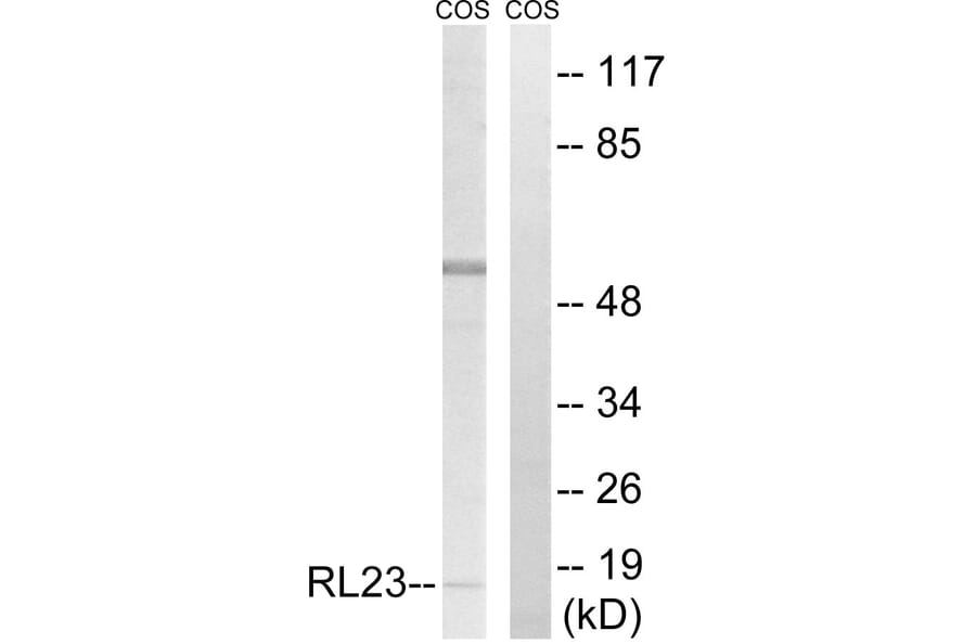 Western Blot - Anti-RPL23 Antibody (C14159) - Antibodies.com