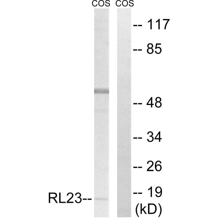 Western Blot - Anti-RPL23 Antibody (C14159) - Antibodies.com