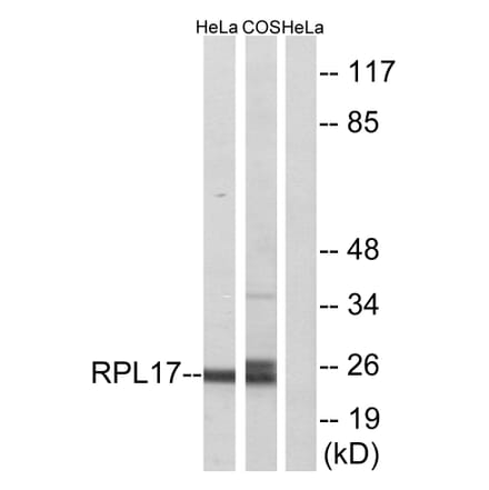 Western Blot - Anti-RPL17 Antibody (C14153) - Antibodies.com