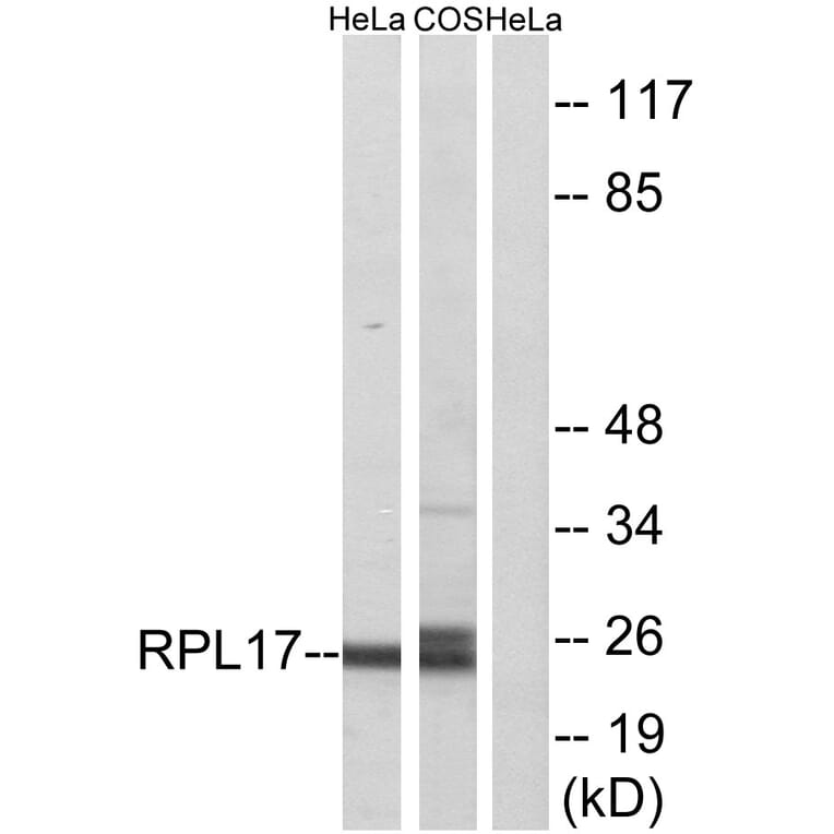 Western Blot - Anti-RPL17 Antibody (C14153) - Antibodies.com