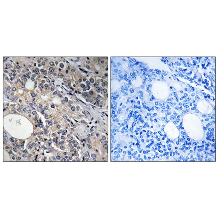 Immunohistochemistry - Anti-RPL17 Antibody (C14153) - Antibodies.com