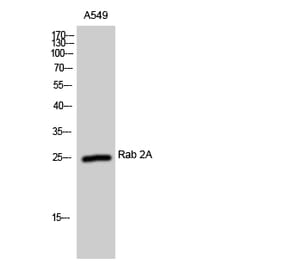 Western Blot - Anti-RAB2A Antibody (C18237) - Antibodies.com