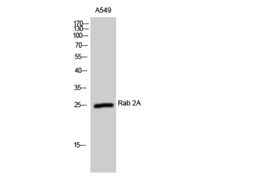 Western Blot - Anti-RAB2A Antibody (C18237) - Antibodies.com