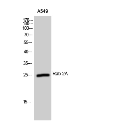 Western Blot - Anti-RAB2A Antibody (C18237) - Antibodies.com