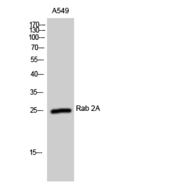 Western Blot - Anti-RAB2A Antibody (C18237) - Antibodies.com