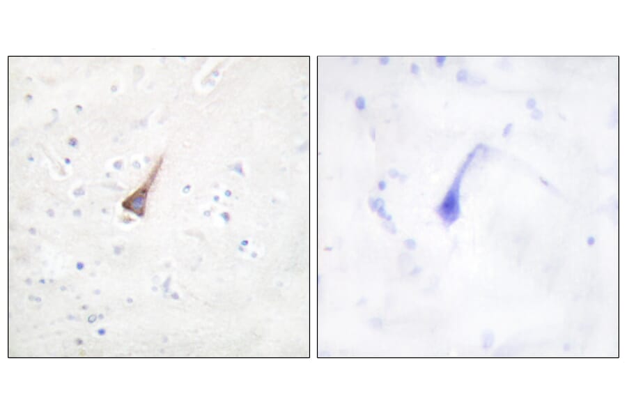 Immunohistochemistry - Anti-PTP1B Antibody (B0809) - Antibodies.com