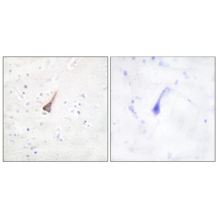 Immunohistochemistry - Anti-PTP1B Antibody (B0809) - Antibodies.com