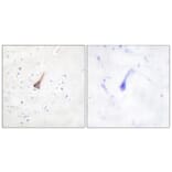 Immunohistochemistry - Anti-PTP1B Antibody (B0809) - Antibodies.com