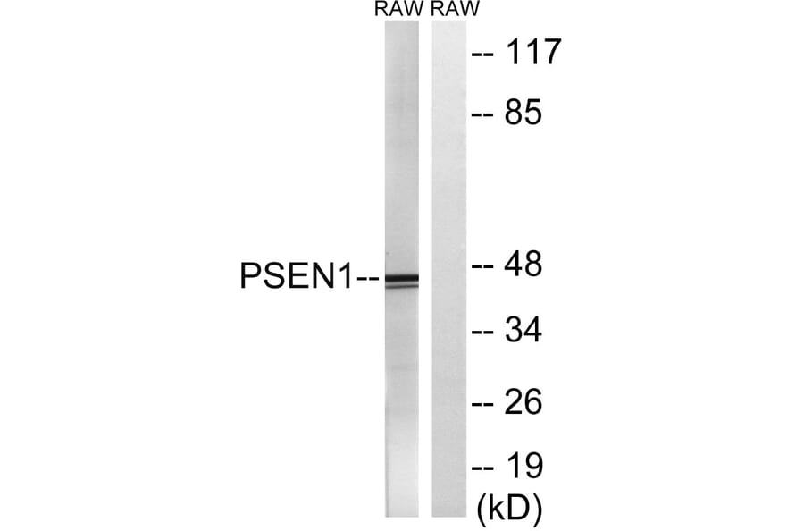 Western Blot - Anti-PSEN1 Antibody (B8404) - Antibodies.com