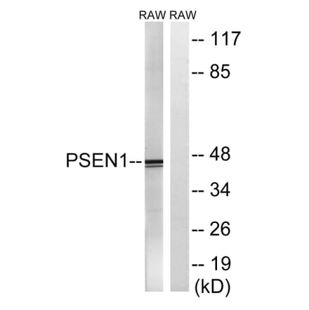 Western Blot - Anti-PSEN1 Antibody (B8404) - Antibodies.com