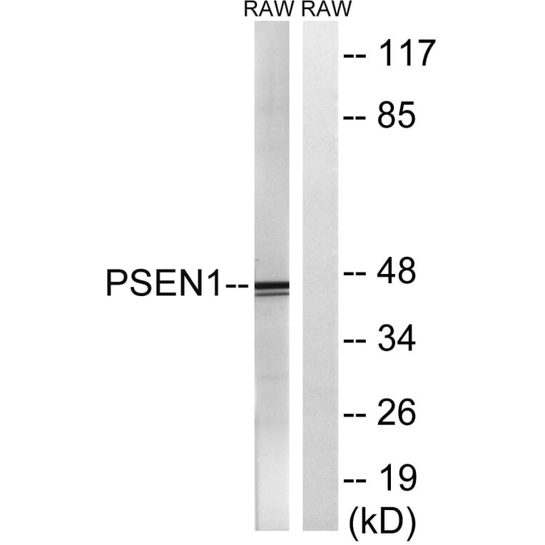 Western Blot - Anti-PSEN1 Antibody (B8404) - Antibodies.com