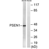 Western Blot - Anti-PSEN1 Antibody (B8404) - Antibodies.com
