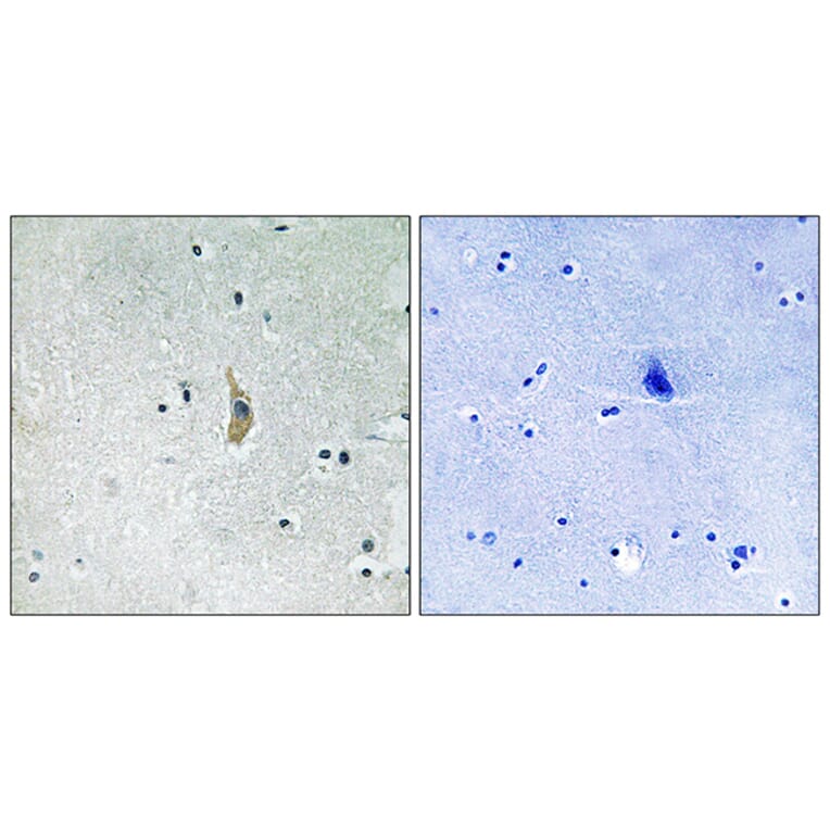 Immunohistochemistry - Anti-PSEN1 Antibody (B8404) - Antibodies.com
