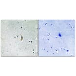 Immunohistochemistry - Anti-PSEN1 Antibody (B8404) - Antibodies.com