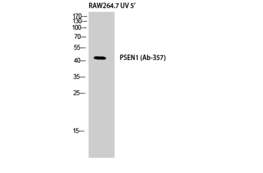Western Blot - Anti-PSEN1 Antibody (B8404) - Antibodies.com