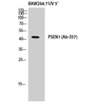 Western Blot - Anti-PSEN1 Antibody (B8404) - Antibodies.com