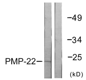 Western Blot - Anti-PMP22 Antibody (C0306) - Antibodies.com