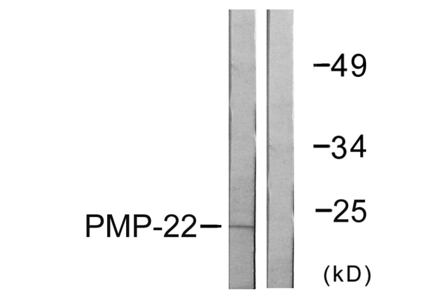 Western Blot - Anti-PMP22 Antibody (C0306) - Antibodies.com