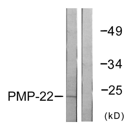 Western Blot - Anti-PMP22 Antibody (C0306) - Antibodies.com