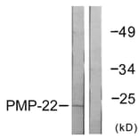 Western Blot - Anti-PMP22 Antibody (C0306) - Antibodies.com