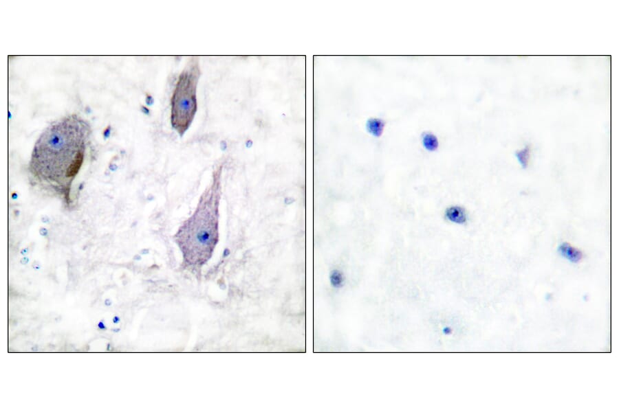 Immunohistochemistry - Anti-PMP22 Antibody (C0306) - Antibodies.com