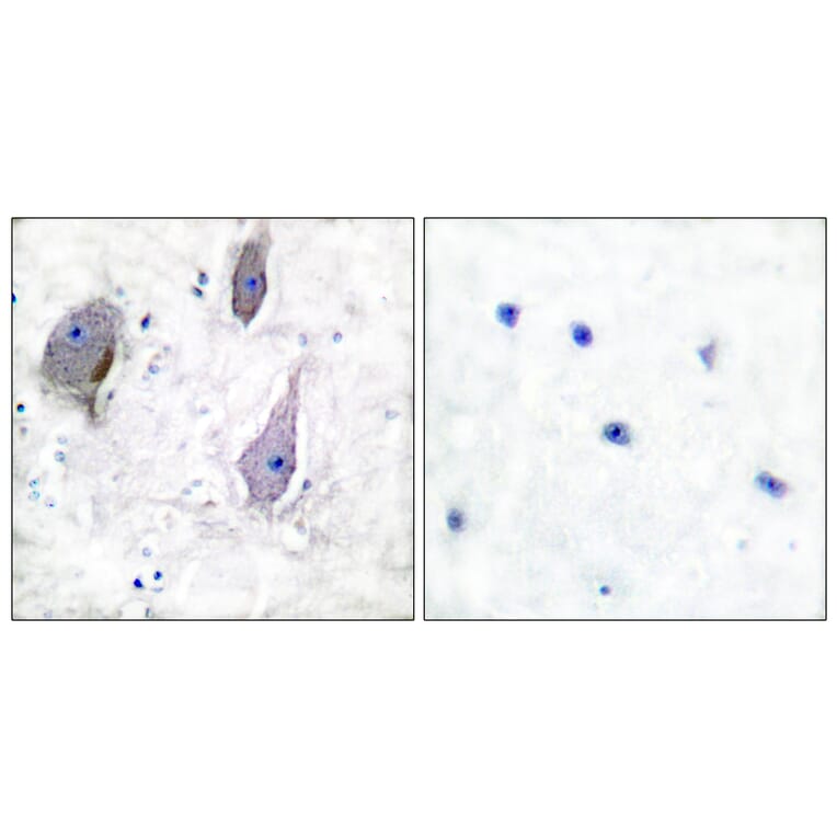 Immunohistochemistry - Anti-PMP22 Antibody (C0306) - Antibodies.com