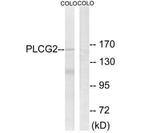 Western Blot - Anti-PLCG2 Antibody (B0081) - Antibodies.com