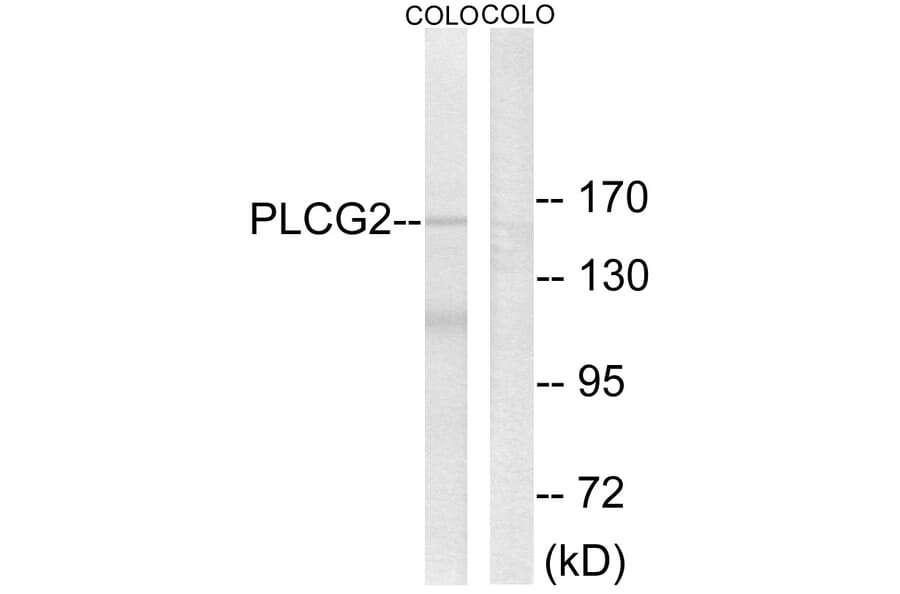 Western Blot - Anti-PLCG2 Antibody (B0081) - Antibodies.com
