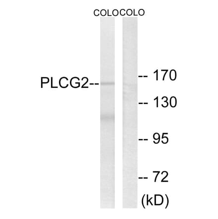 Western Blot - Anti-PLCG2 Antibody (B0081) - Antibodies.com