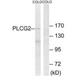 Western Blot - Anti-PLCG2 Antibody (B0081) - Antibodies.com