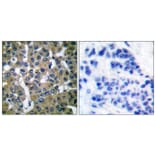 Immunohistochemistry - Anti-PLCG2 Antibody (B0081) - Antibodies.com