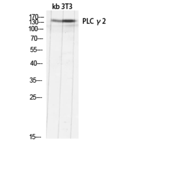 Western Blot - Anti-PLCG2 Antibody (B0081) - Antibodies.com