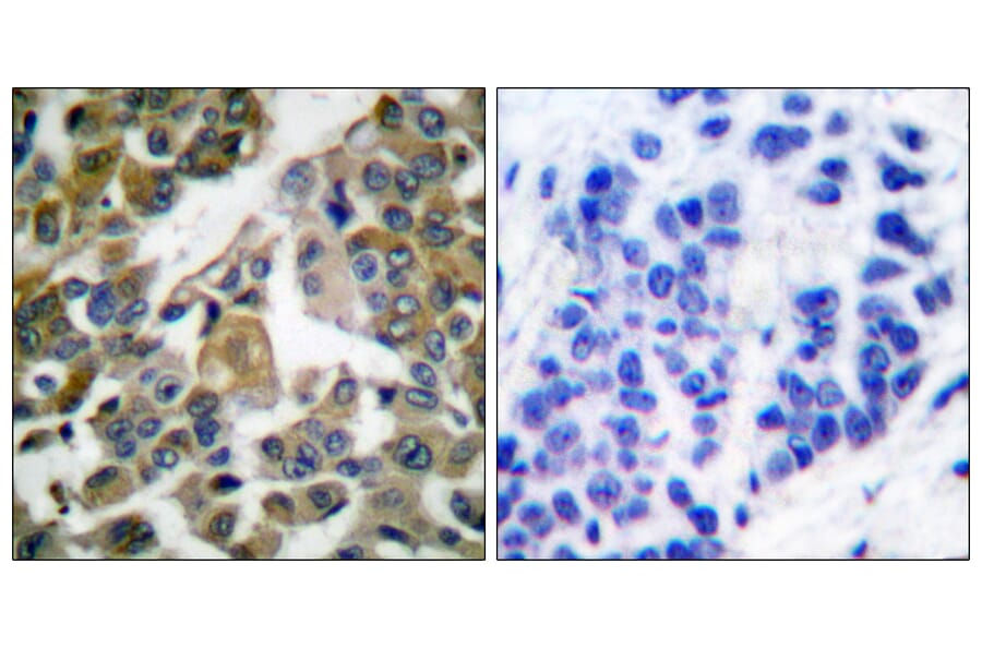 Immunohistochemistry - Anti-PLCG1 Antibody (B0080) - Antibodies.com