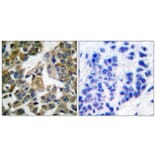 Immunohistochemistry - Anti-PLCG1 Antibody (B0080) - Antibodies.com