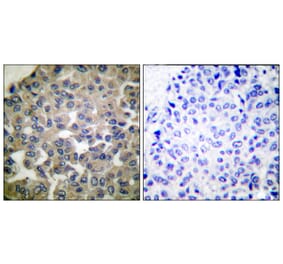 Immunohistochemistry - Anti-PLCG1 Antibody (B0079) - Antibodies.com