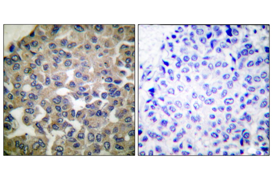 Immunohistochemistry - Anti-PLCG1 Antibody (B0079) - Antibodies.com